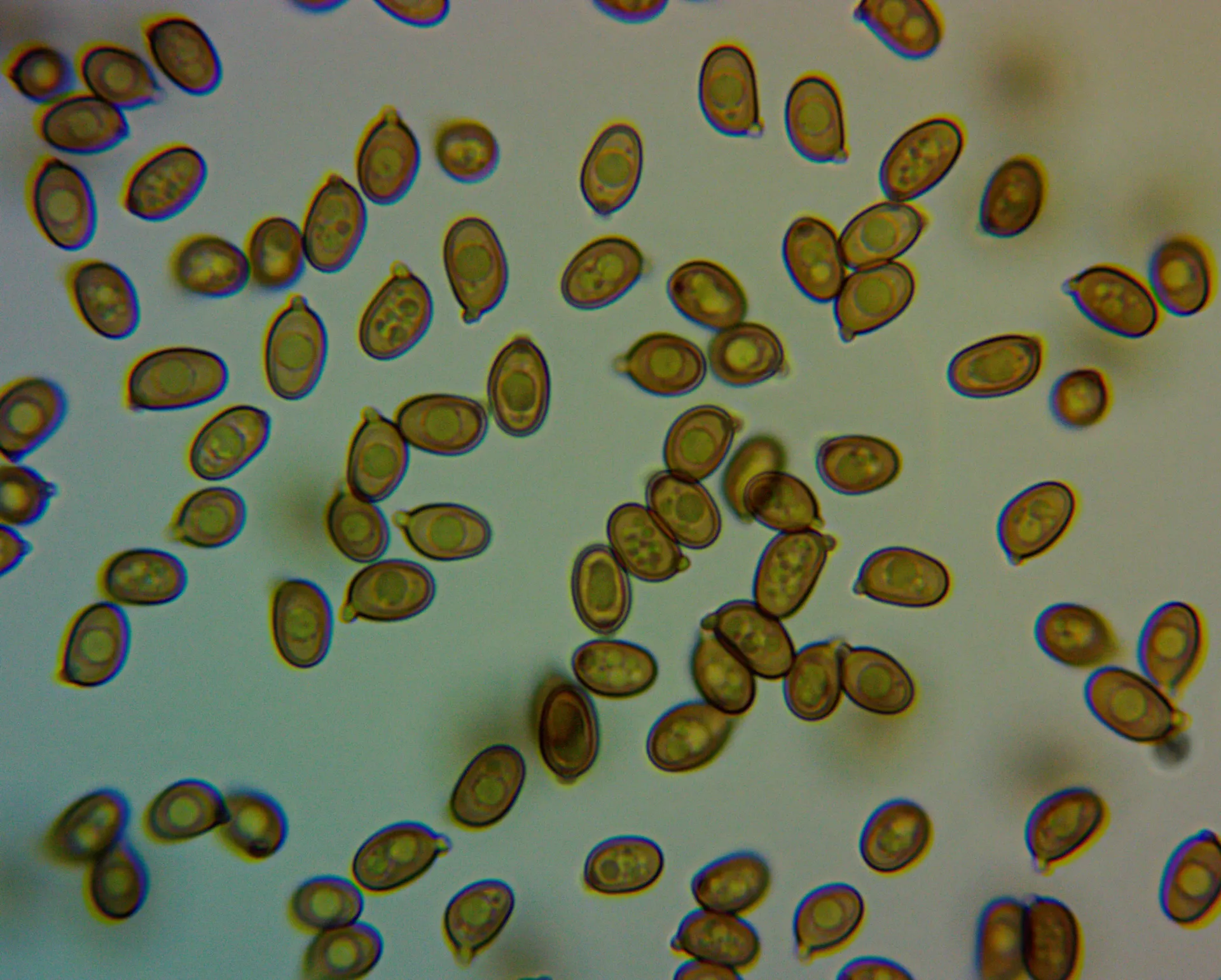 Ag. depauperatus esporas